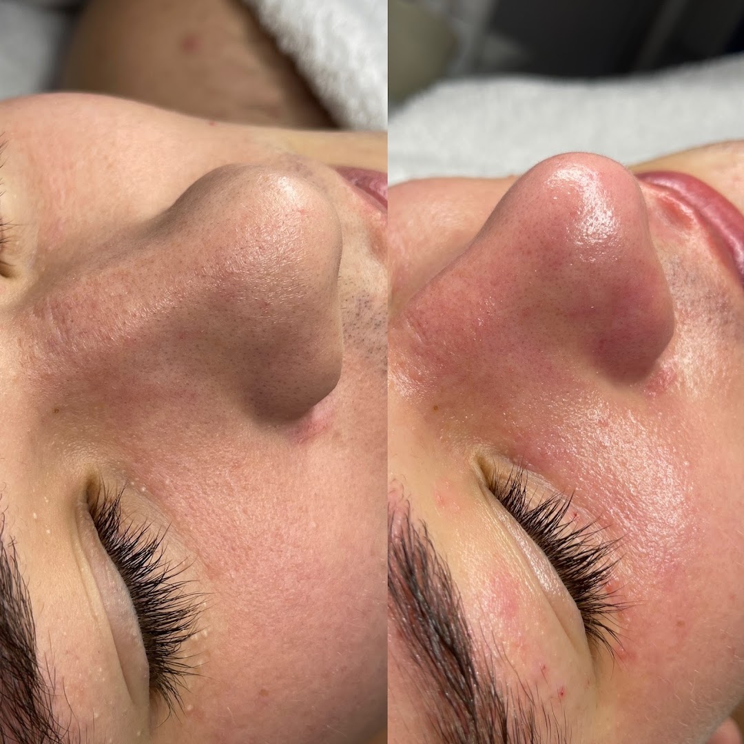 Beauty Lounge | Claudia Zemin - Trucco permanente e trattamenti viso · Foto 6